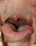 Воспаление в горле фото 1