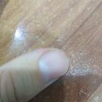 Проблема с ногтями трещины на пальце большем ноге и руке фото 1