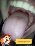 Бугры на корне языка и зуд в горле фото 2