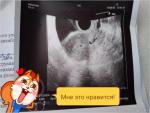 Беременность 1-2 недели фото 1