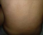 У грудничка сыпь на спинке фото 2