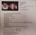 Результаты УЗИ о кисте на правом яичнике фото 2