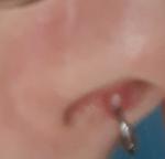 Воспаление прокола носа фото 2