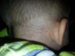 Риск заражения ребенка гепатитом в парихмахерской фото 1