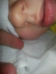 Полопались сосуды на кончике носа у ребенка фото 1
