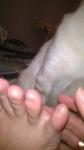 Воспаление между пальцами ног фото 2