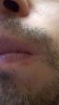 Сухость кожи, шелушение и странные катушки в волосистой части усов фото 3