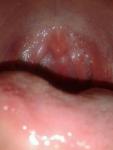 Проблемы со всей слизистой носа, языка, горла фото 2