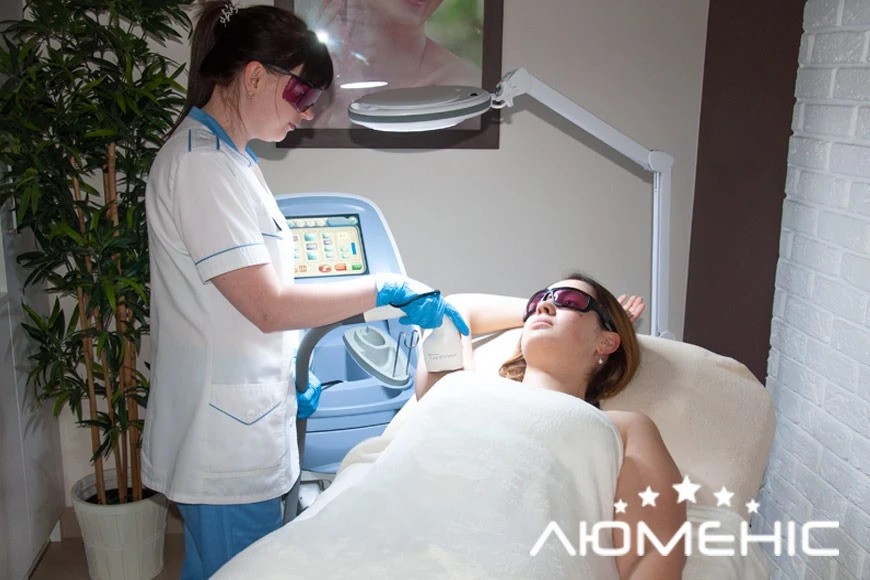 лазерная эпиляция