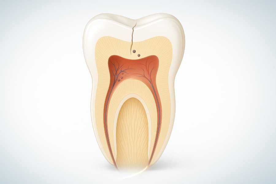 зуб в разрезе