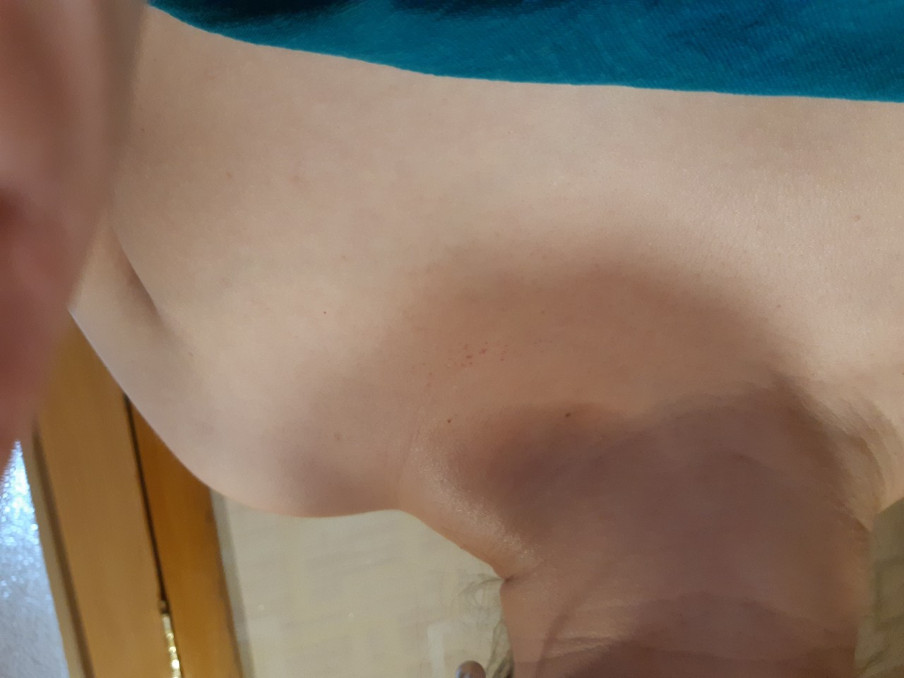 шишка в правой груди у женщин фото 104