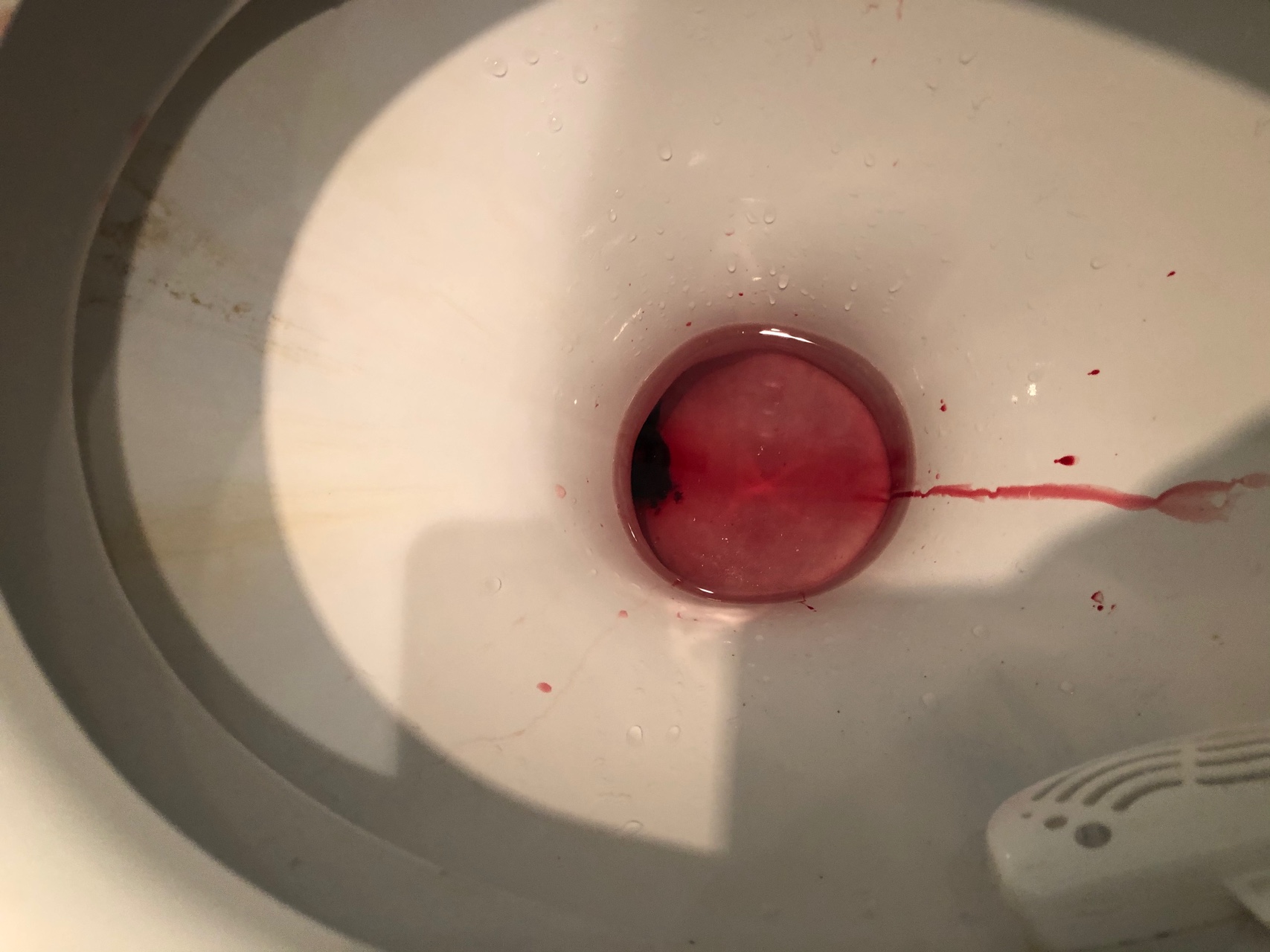 кровяные сгустки в сперме у мужчин фото 88