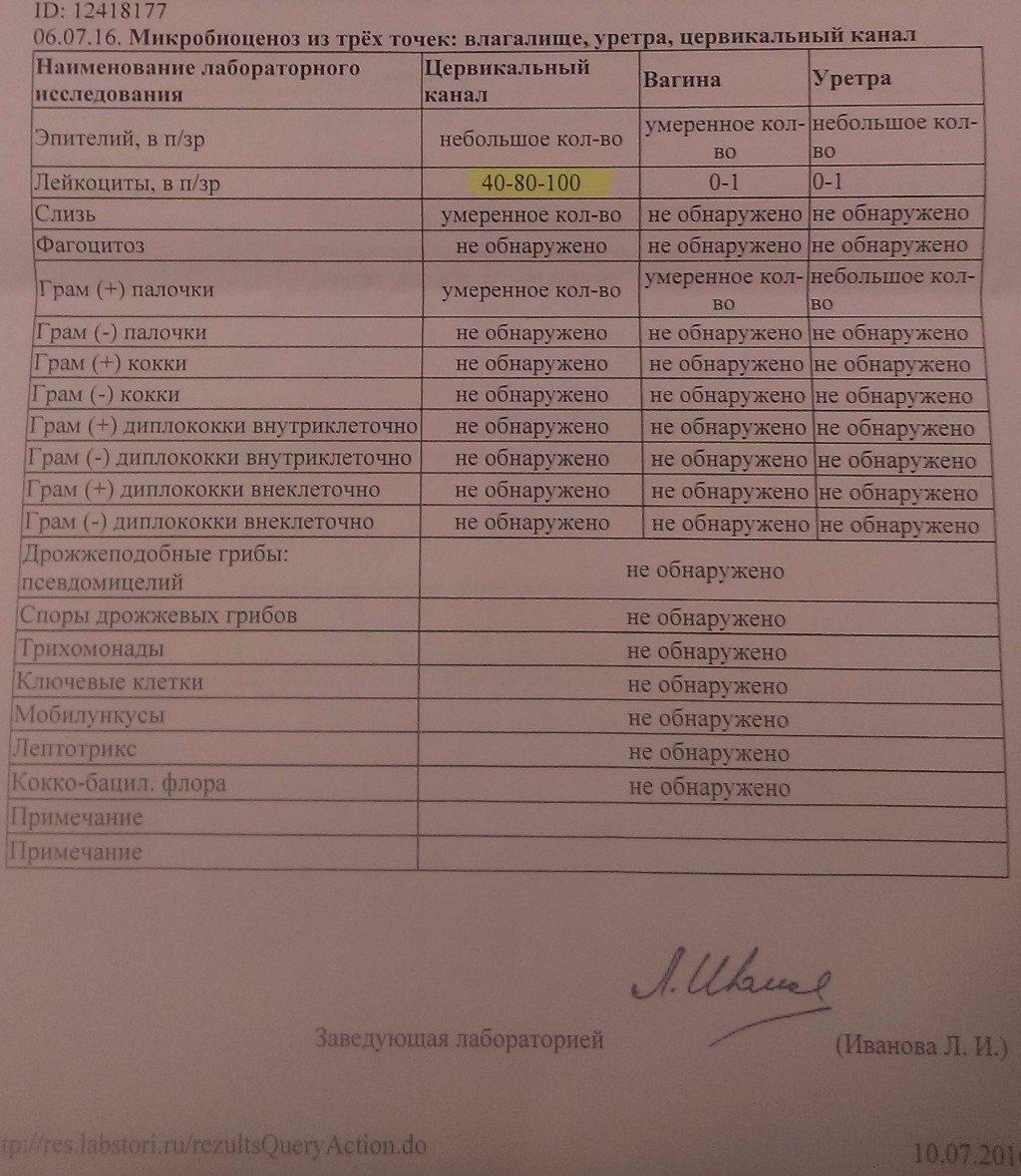 Когда можно сдавать анализы после антибиотиков. Микробиоценоз анализ. Исследование на микробиоценоз. Мазок на микробиоценоз. Мазок на микробиоценоз влагалища.