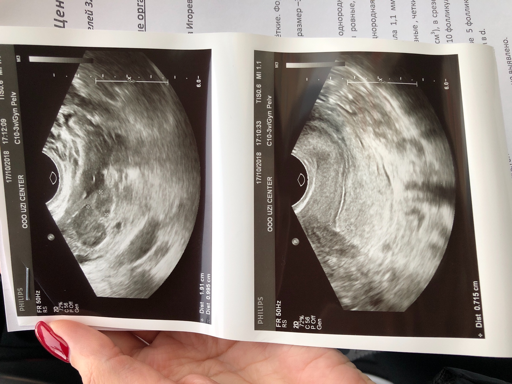 4 недели беременности сдулась грудь фото 11