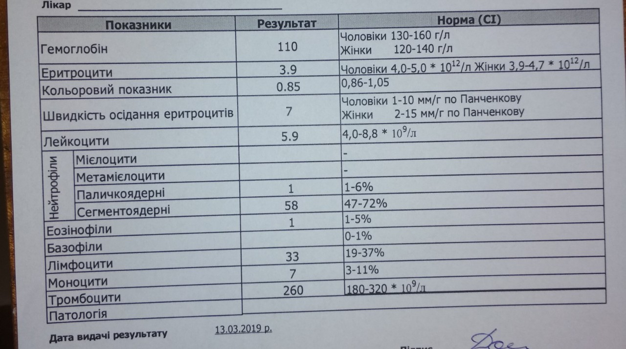 Анализ на креатинин. Анализ мочи на креатинин. Общий анализ мочи креатинин норма. Креатинин в общем анализе мочи. Мочевина в моче общий анализ.