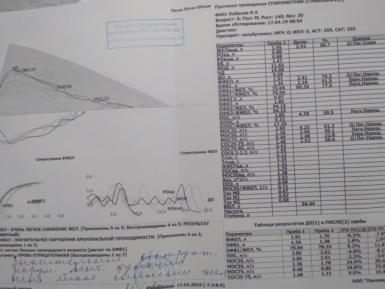 Результаты спирографии