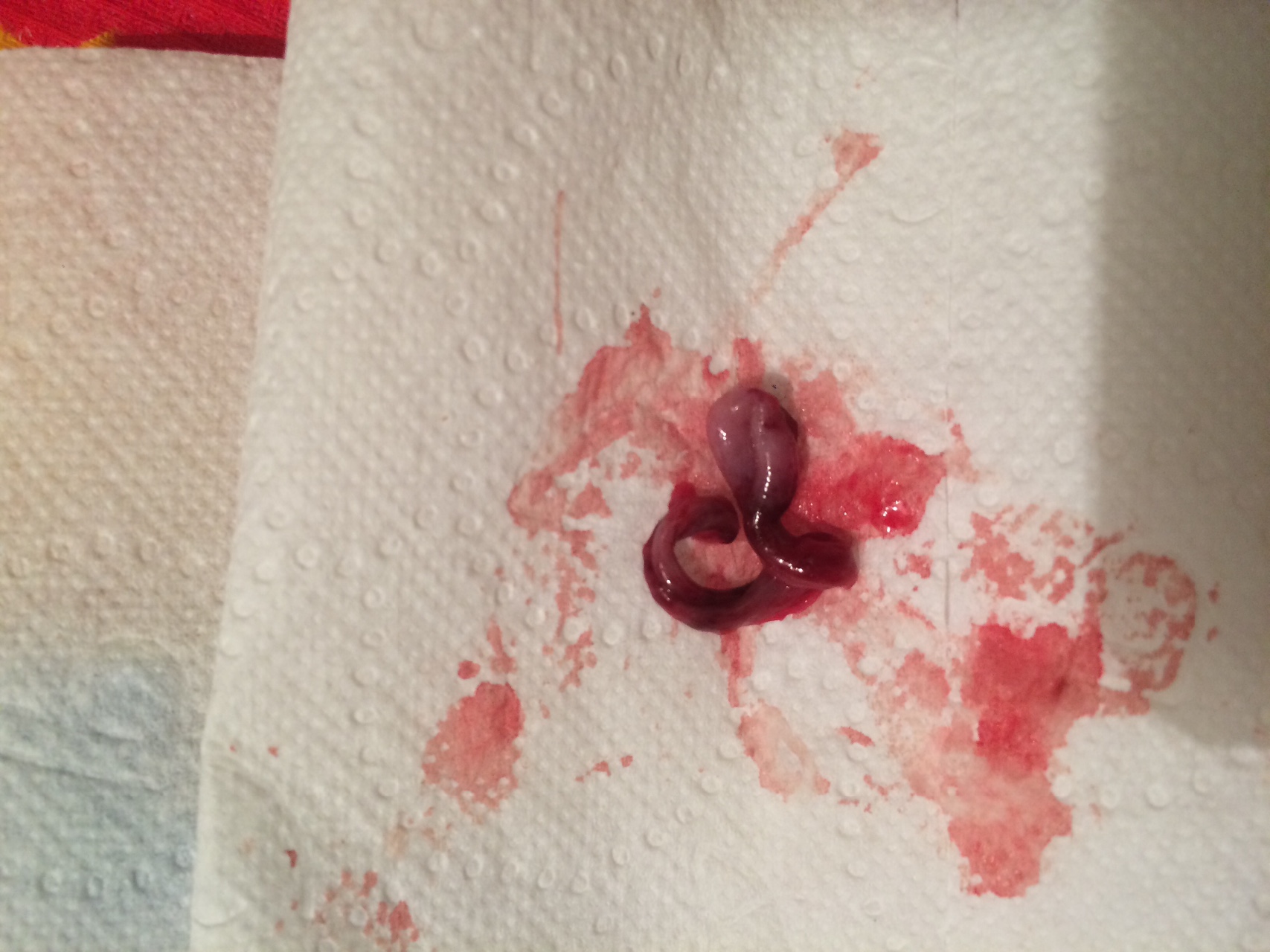 сгустки крови в сперме мужчин фото 77