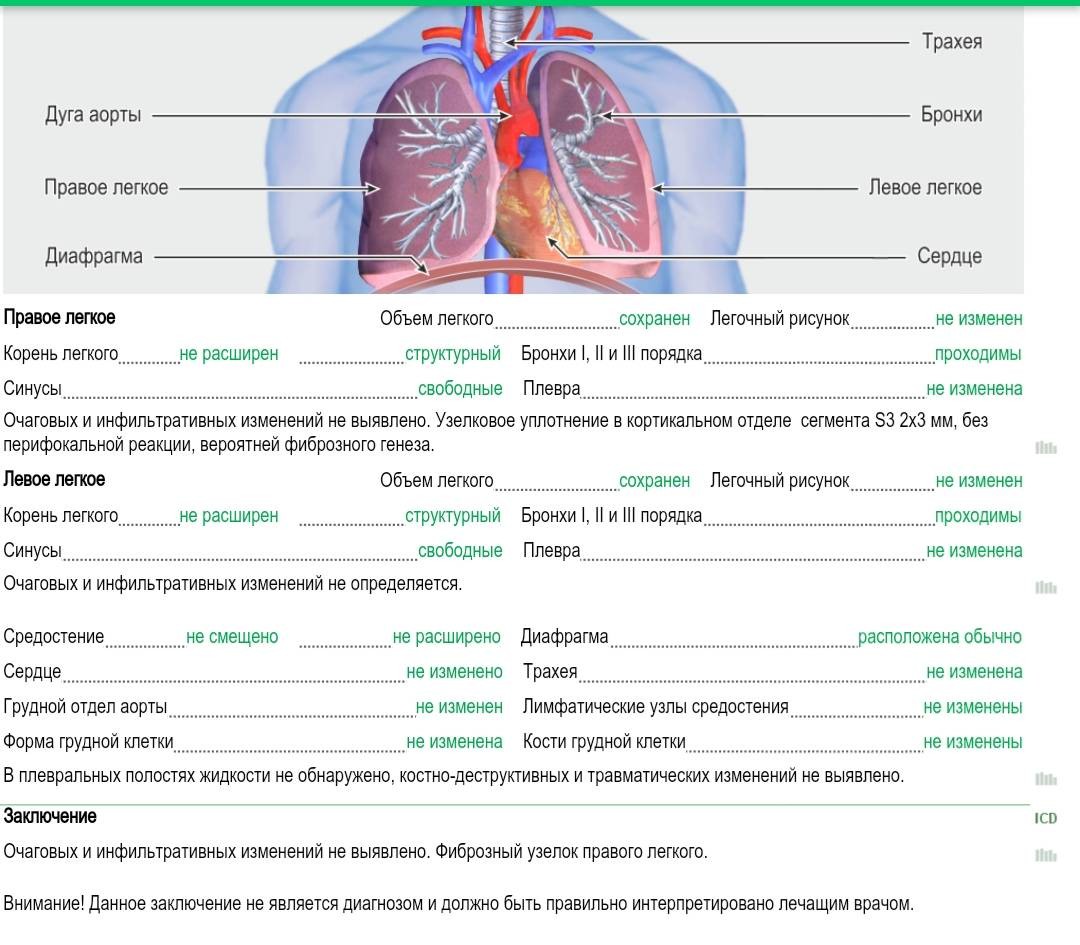 Левое корень правое. Легочный рисунок несколько усилен что это. Субплевральные отделы легких. Прикорневые отделы легких. Усиление бронхолегочного рисунка.