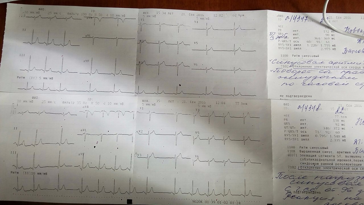 Экг поликлиника 2