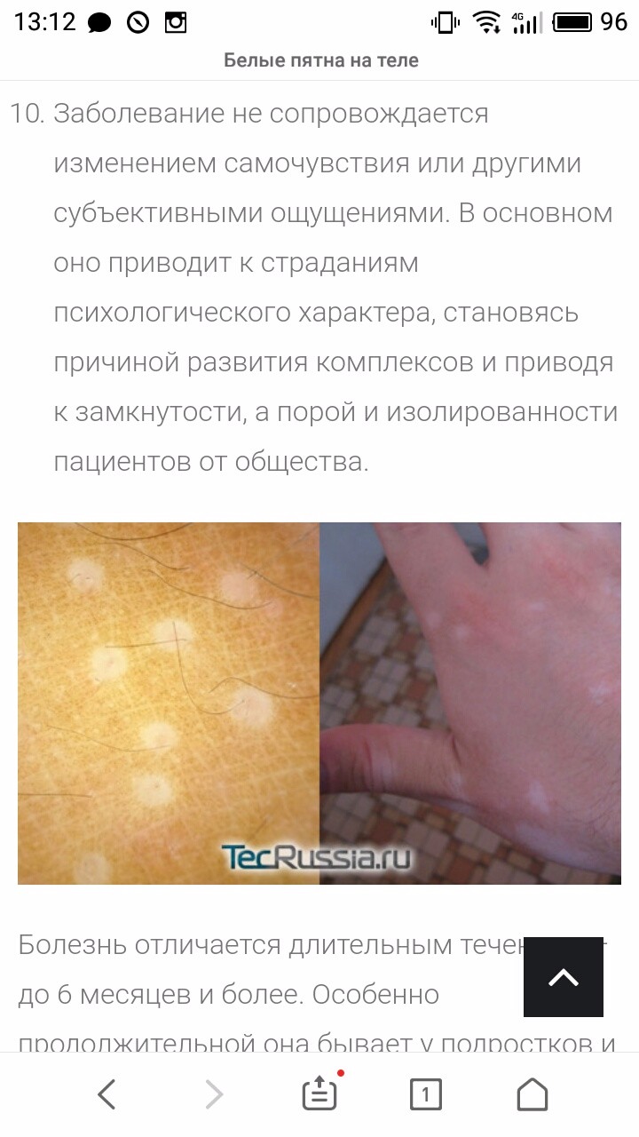 Белые пятна на коже - Вопрос дерматологу - 03 Онлайн