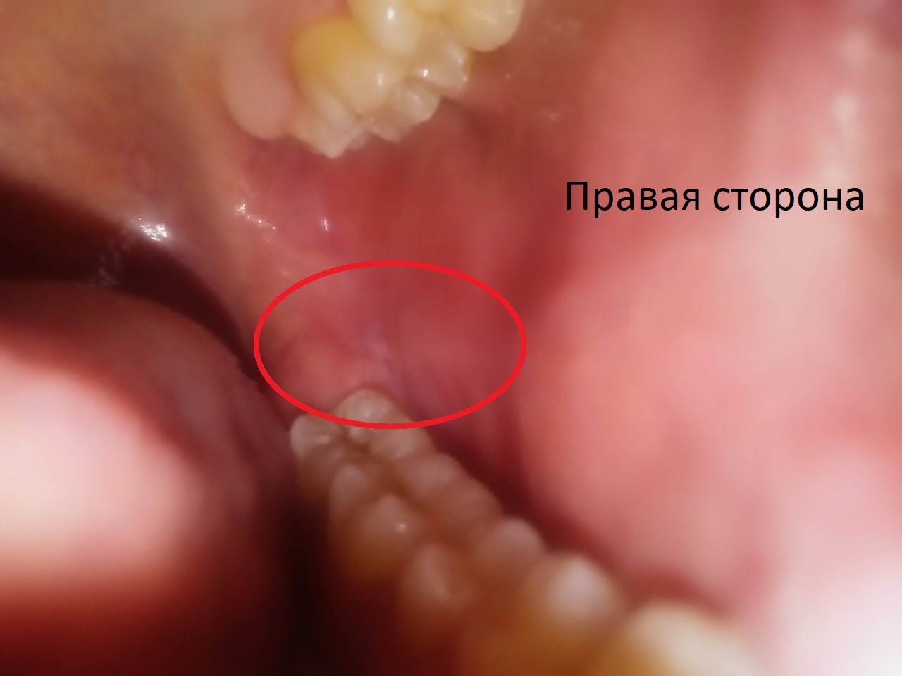 после минета болит челюсть фото 55