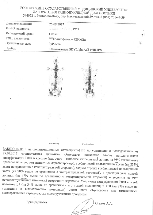 Что такое рфп при пэт