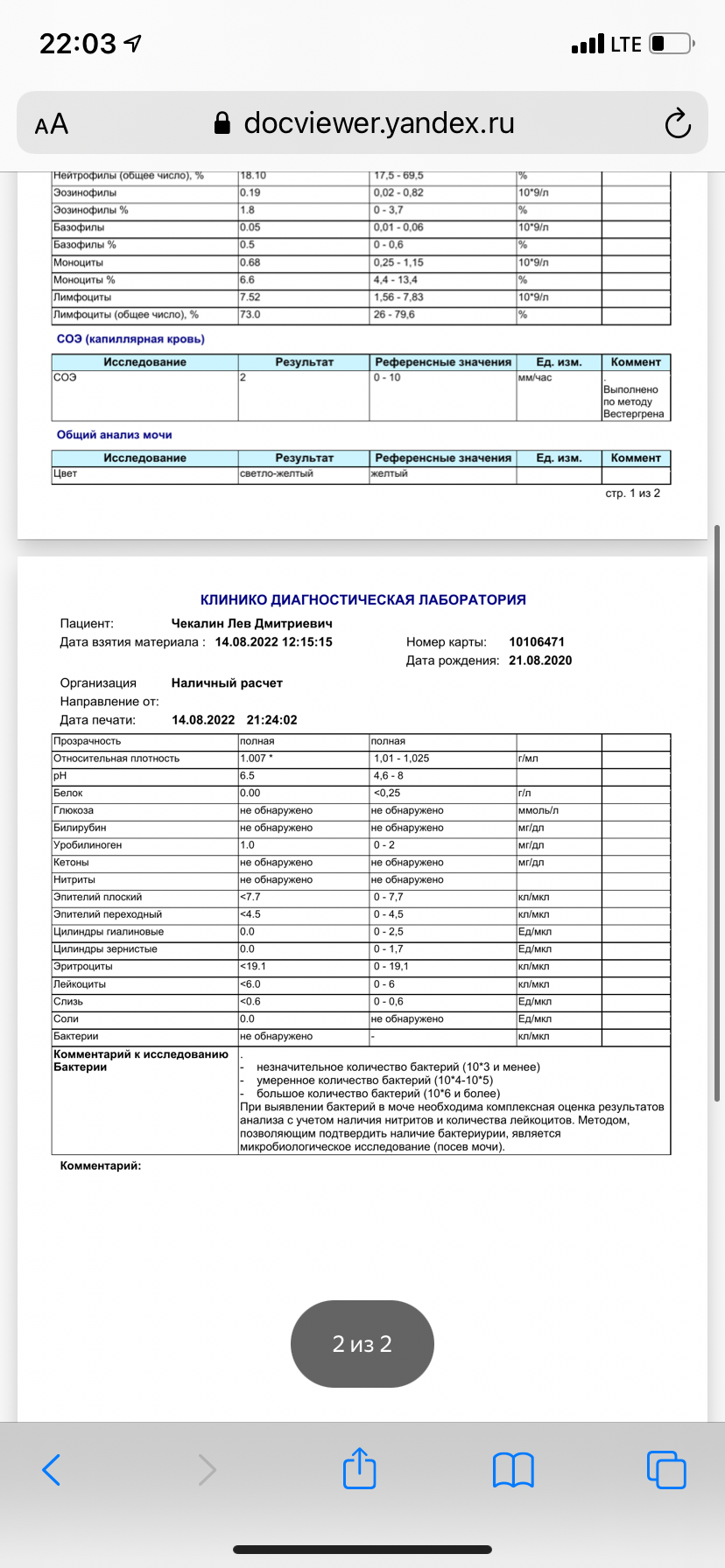 Нужно ли после ибп ставить автомат