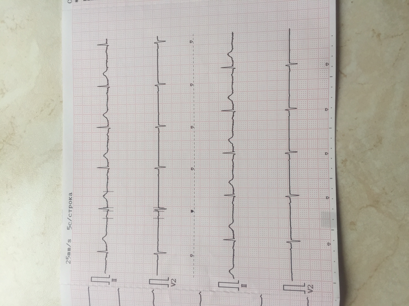 Сделать экг с расшифровкой. Расшифратор ЭКГ по фото. ЭКГ В Смоленске где сделать с расшифровкой. ЭКГ Иваново где сделать. ЭКГ С расшифровкой в Зябликово недорого.