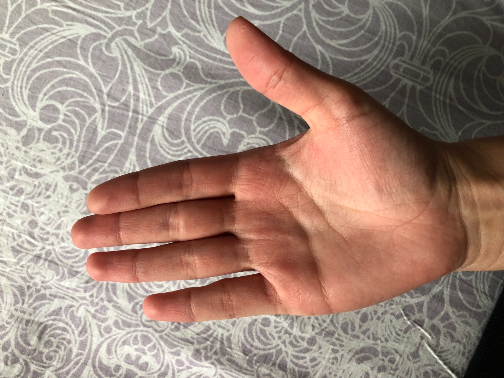 Почему чешутся пальцы на левой руке