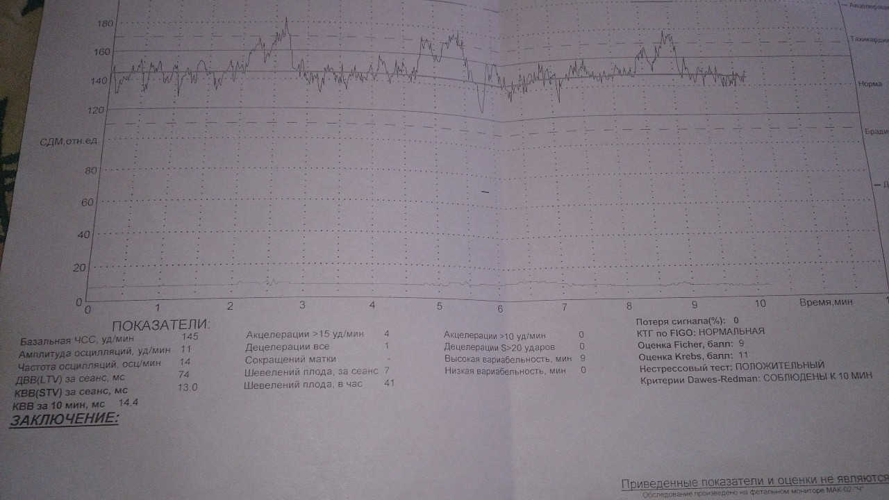 Ктг на 39 неделе беременности