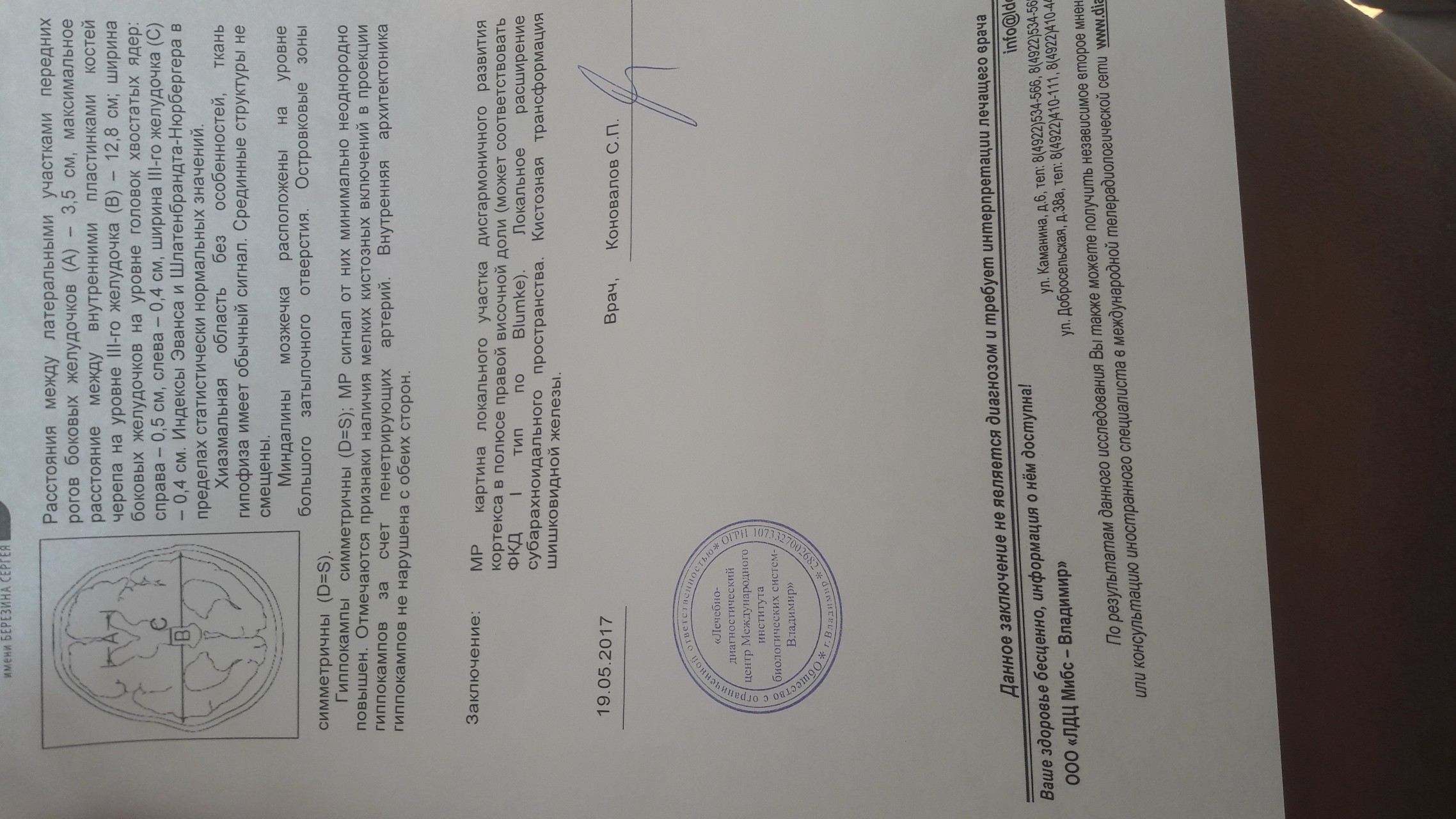 Расшифровка МРТ киста шишковидной железы - Вопрос невропатологу - 03 Онлайн