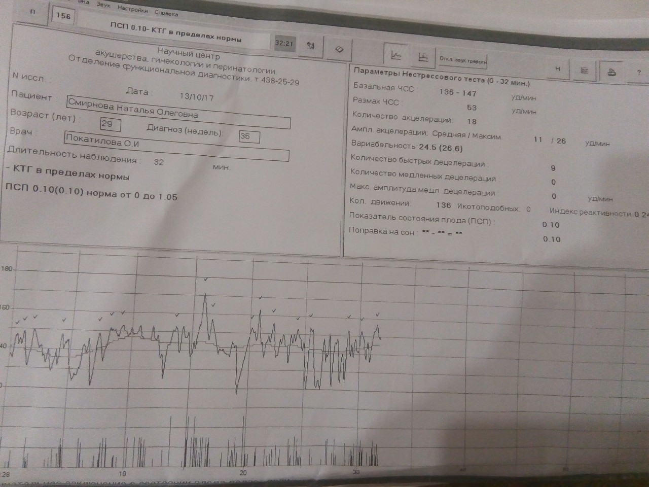 Показатели ктг норма