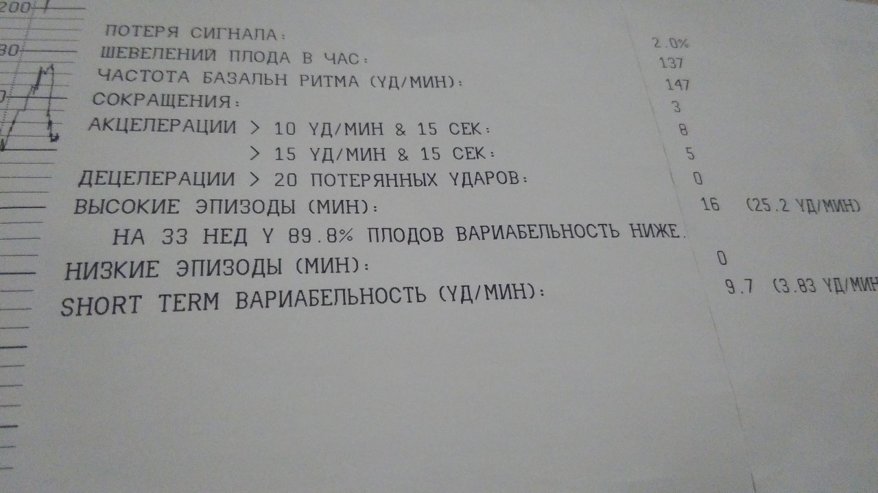 32 неделя беременности шевеления плода