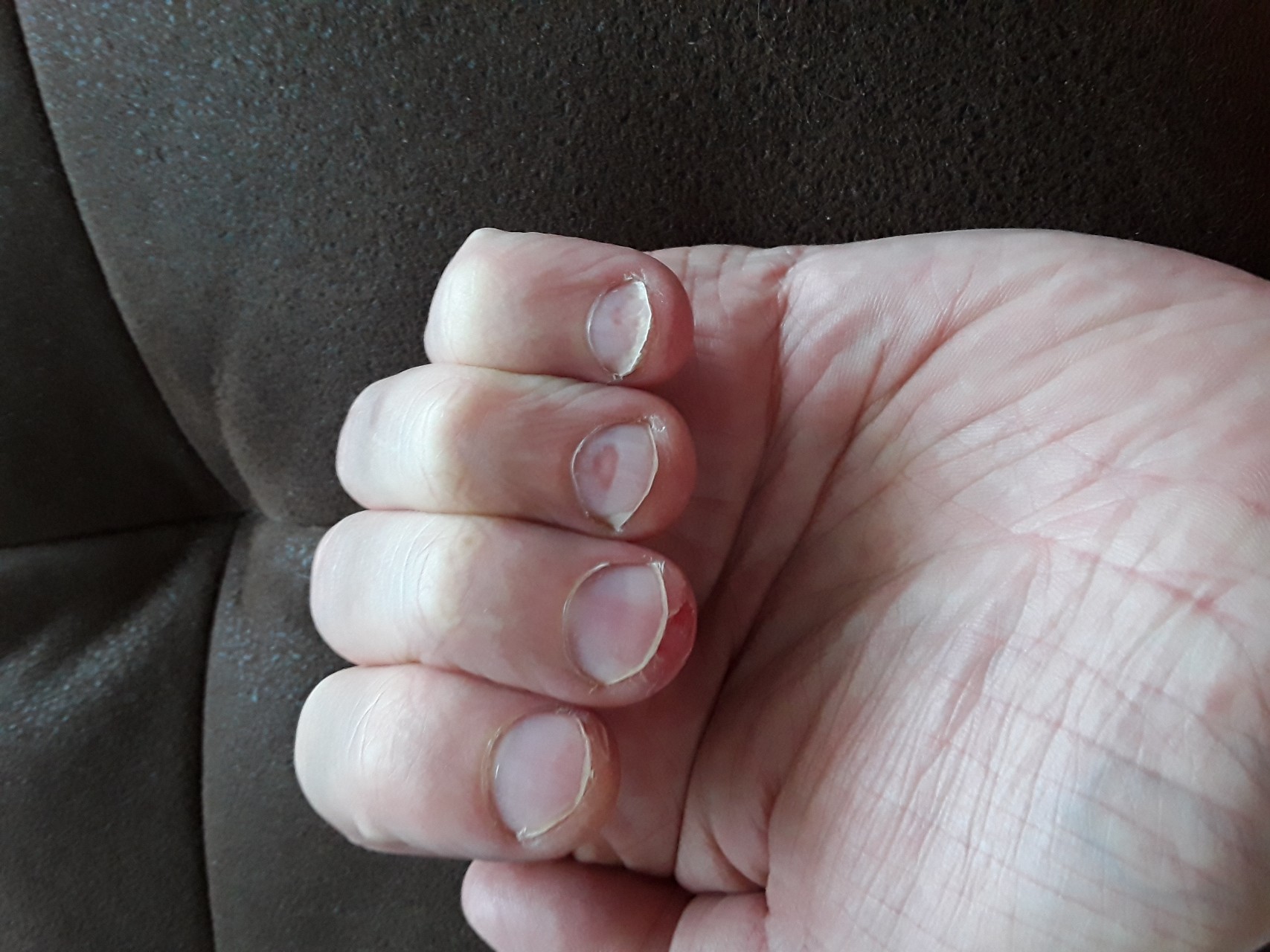 Ногти на больших пальцев мужчин. Широкие ногти. Некрасивые короткие ногти. Маникюр на короткие широкие ногти. Некрасивые широкие ногти.