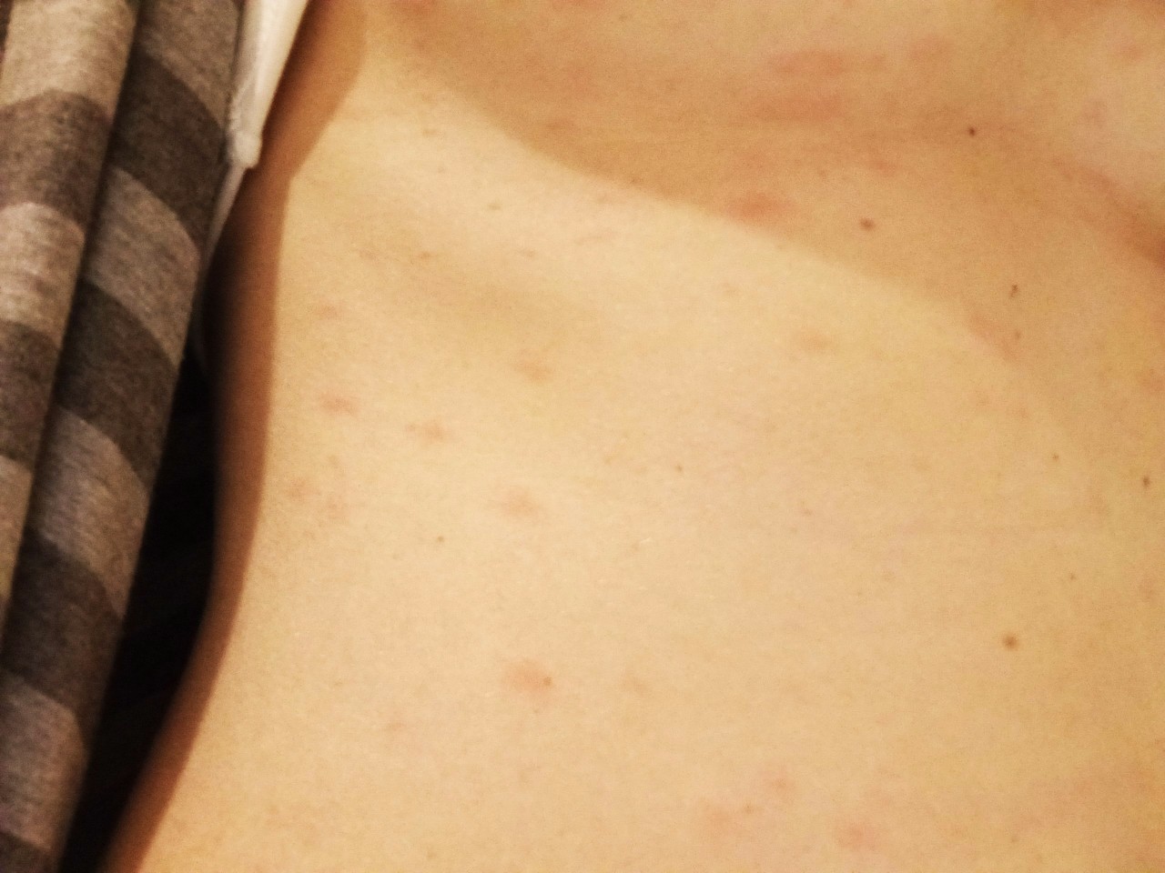 аллергия на груди у беременной фото 93