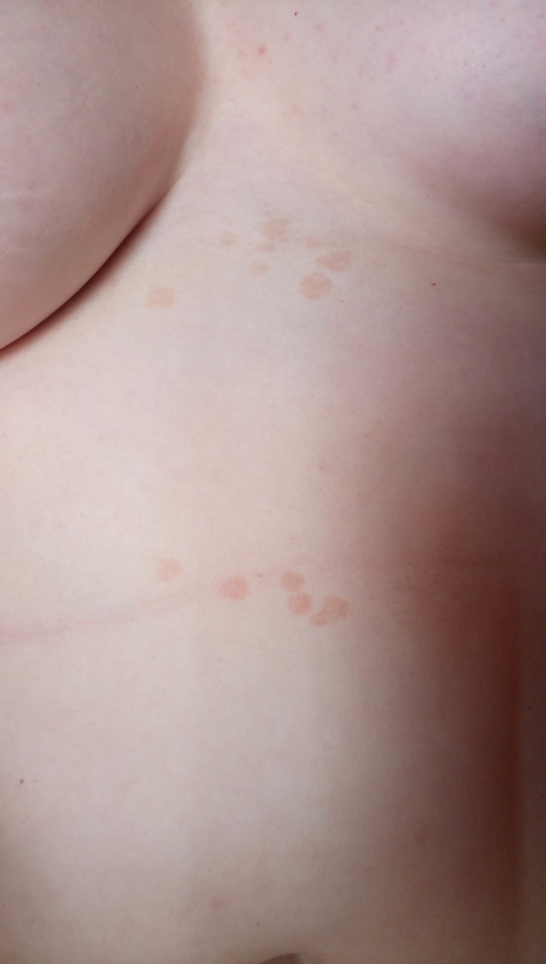красные точки на груди при беременности фото 70