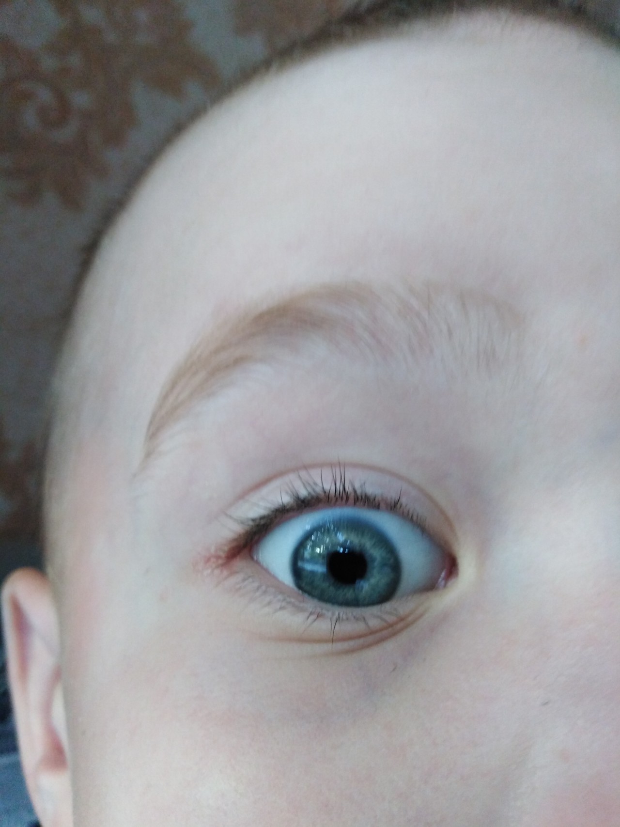 Eye corner. Покраснение в уголке глаза. Покраснение в уголке глаза у ребенка. Наружный уголок глаза.