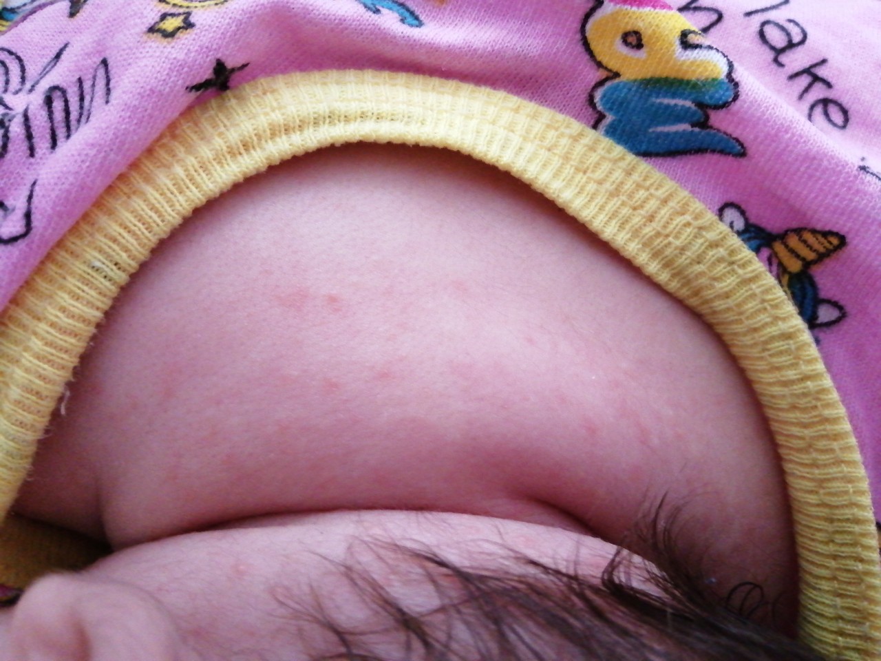 у новорожденного припухла одна грудь фото 52