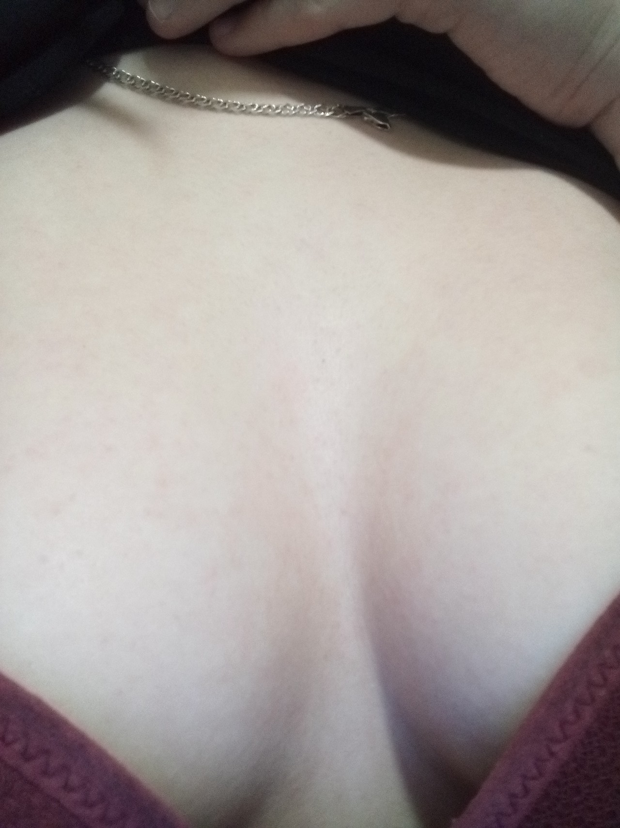 мелкая сыпь на груди у женщин фото 94