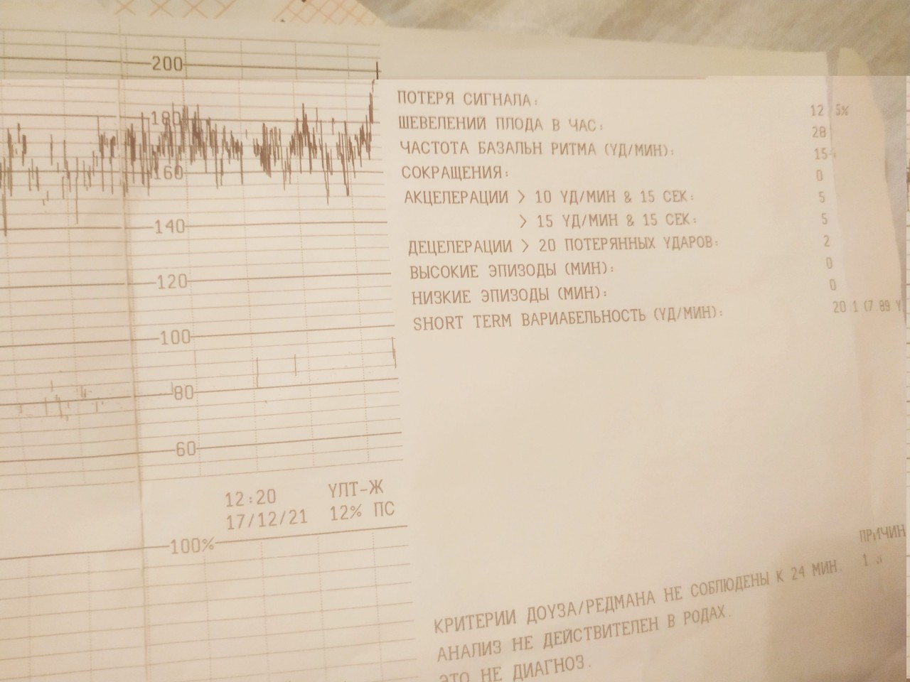 Осмотр на кресле в 33 недели