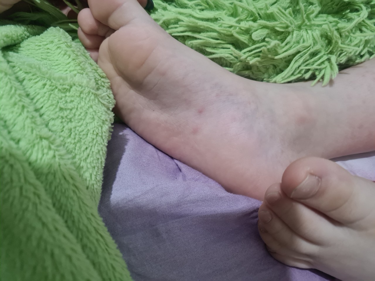 волосатые ноги у ребенка 6 лет фото 69