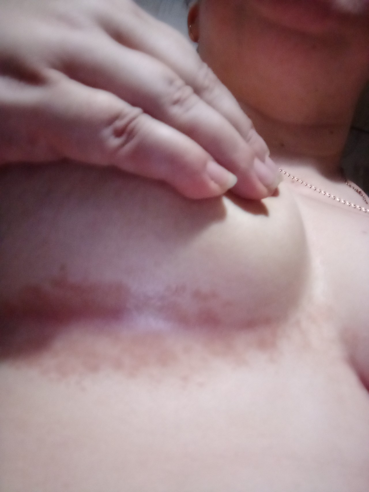 светло коричневые пятна на груди у женщин фото 71