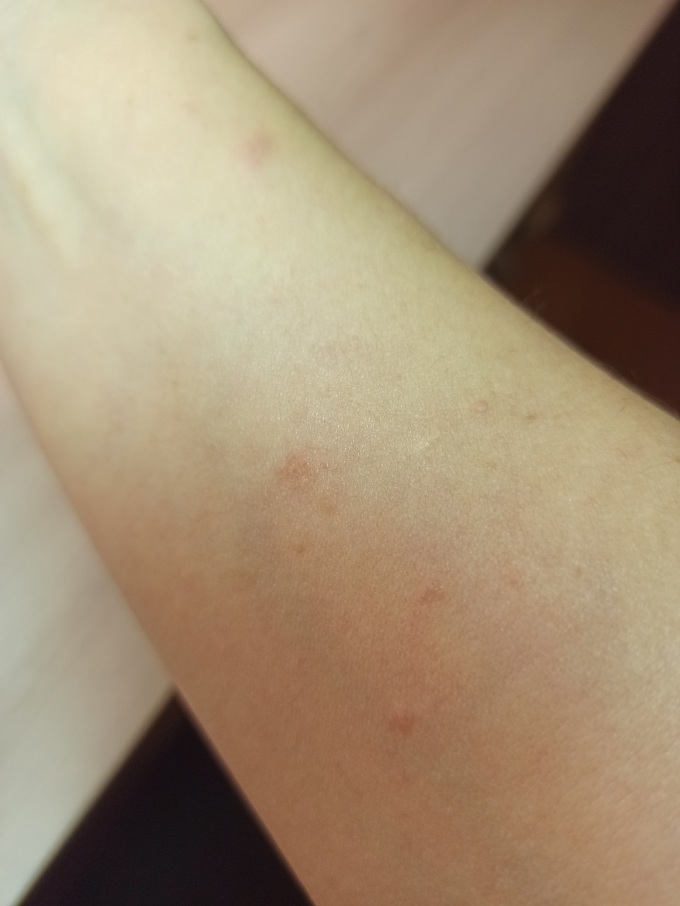 аллергия красные пятна на теле фото