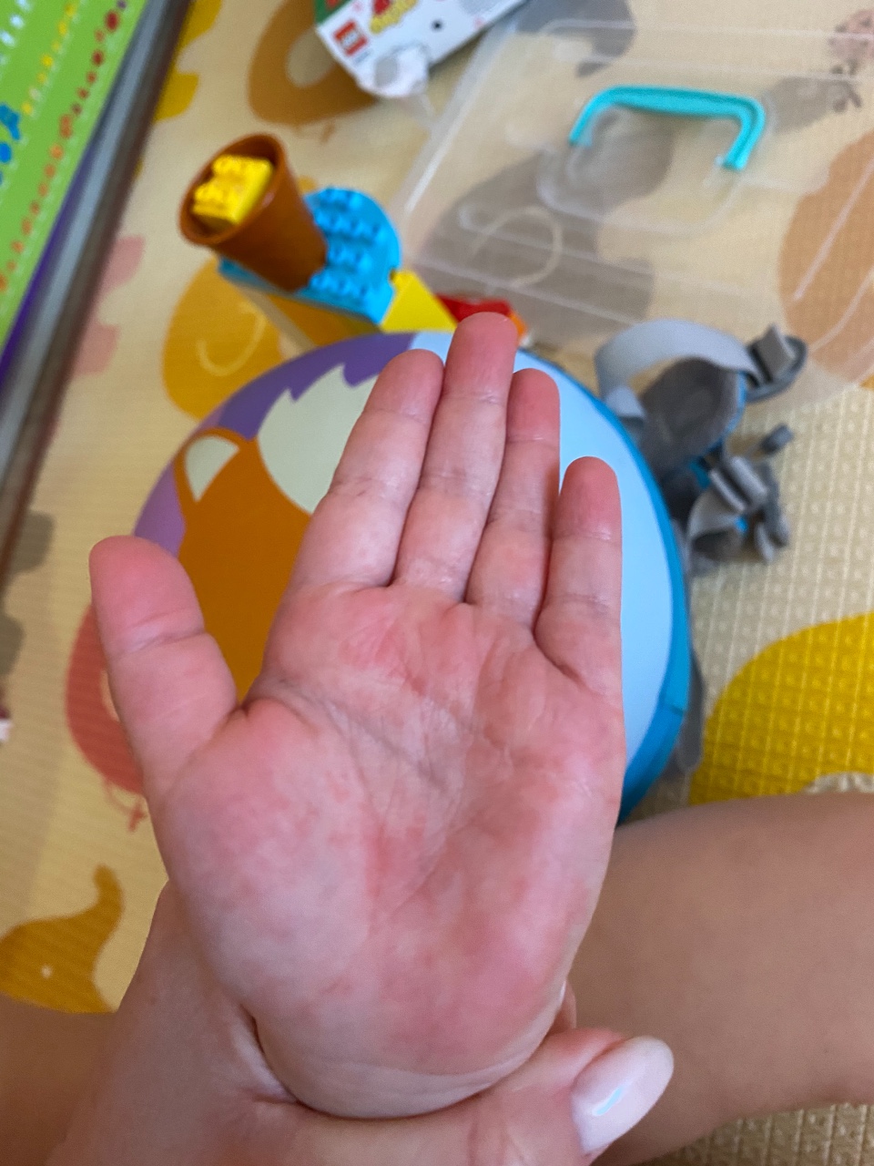 ребенок уронил на палец табуретку