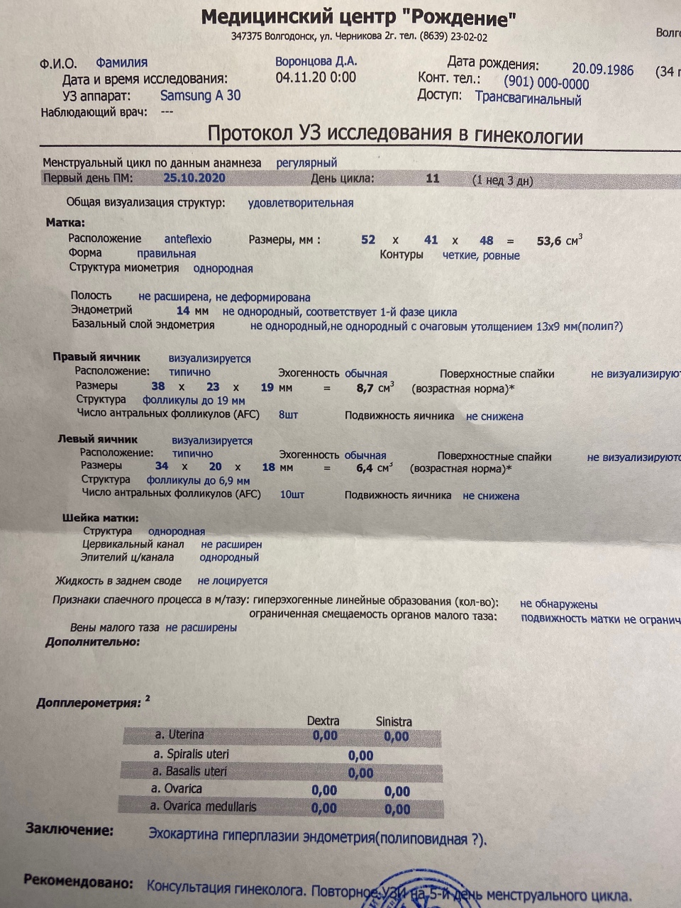 Норколут после отмены через. Полип Норколут. Норколут схема приема при кисте яичника. Полип Норколут Назначение. Нарколут выписка врача фото.