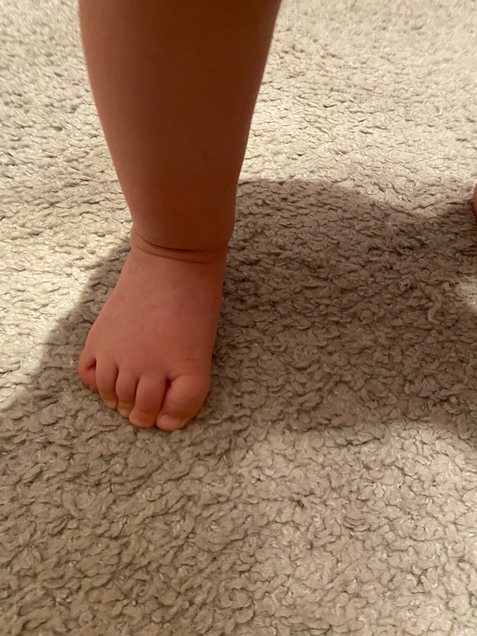 Почему дети поджимают ноги