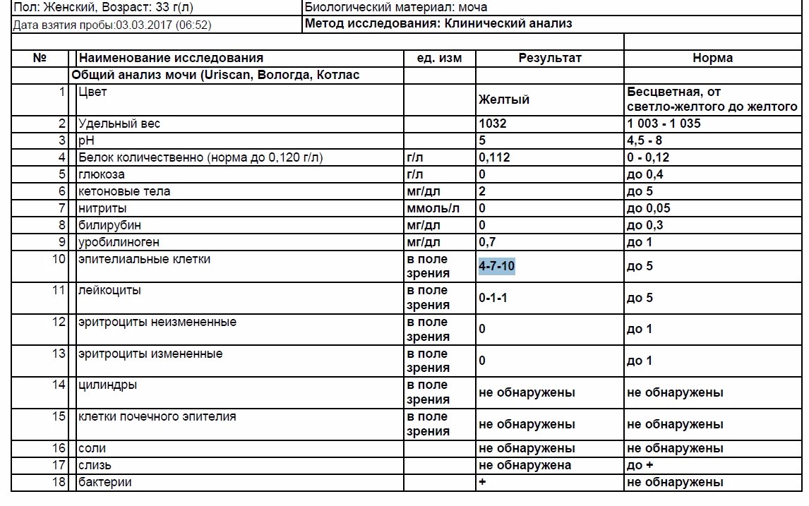 Уробилиноген норма у женщин. Эпителиальные клетки в анализе мочи. Эпителиальные клетки v норма. Эпителиальные клетки значительное количество. Эпителиальные клетки в моче норма.