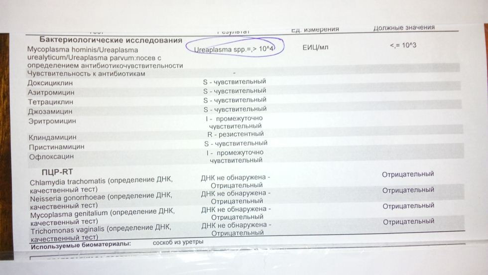 Днк parvum. Уреаплазма специес бак посев. Бак посев на хламидии. Бак посев чувствительность хламидий. Бак посев чувствительность к антибиотикам уреаплазма.