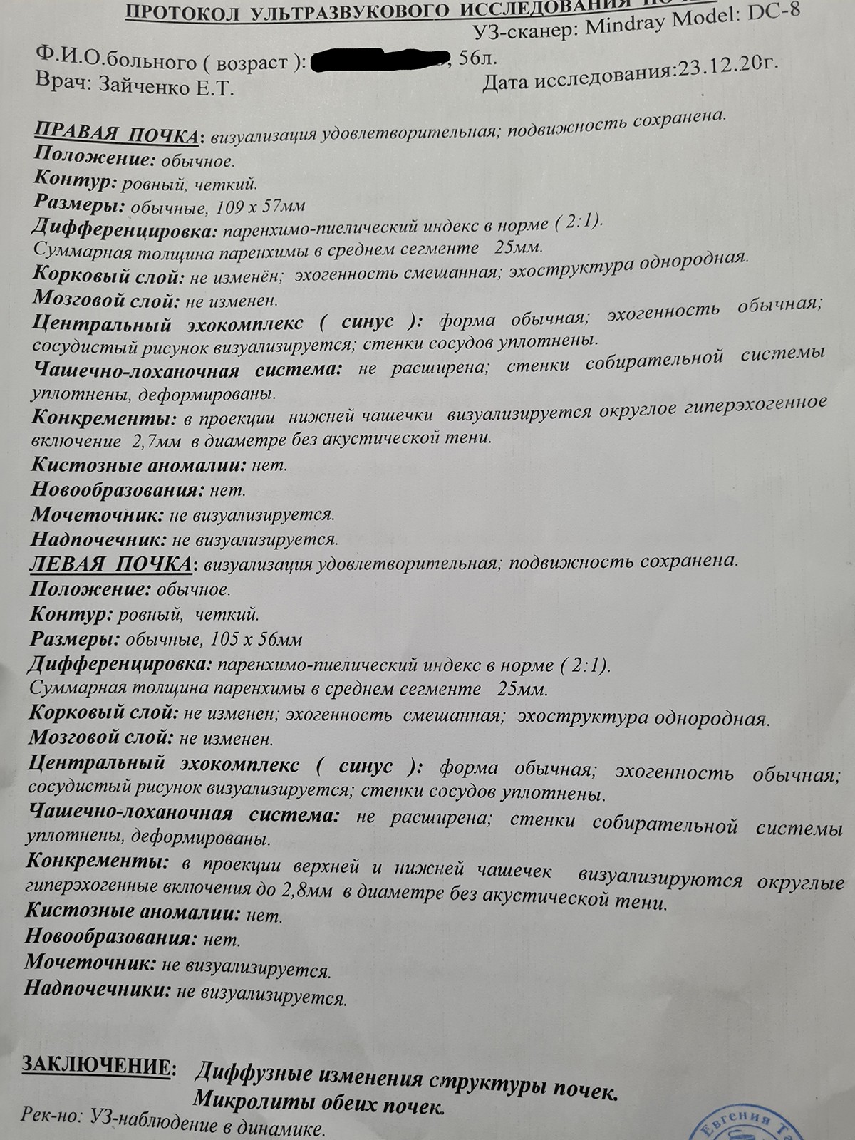 Микролиты в почках что. УЗИ заключение микролиты почек. УЗИ почек протокол норма. УЗИ протокол микролиты в почках. УЗИ почек описание.