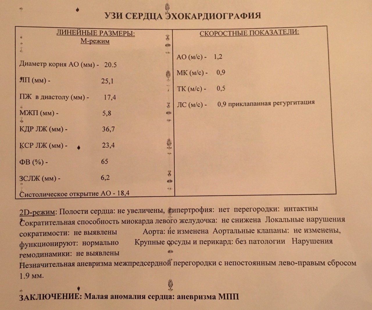 Аневризма мпп. Аневризма МПП на ЭХОКГ. Аневризма межсердечной перегородки. Аневризма МПП на УЗИ.